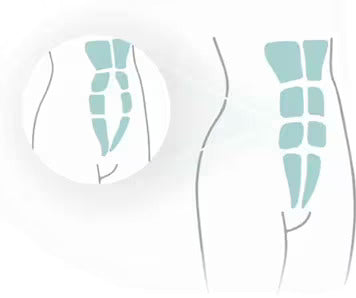 Diastasis Recti?