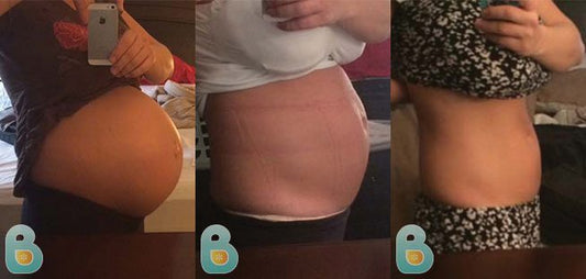 10-Amina-H-Bellefit-Results-Before-and-After-Bellefit-SLIDE