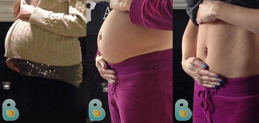 100-Kristine-B-Bellefit-Results-Before-and-After-Bellefit-SLIDE