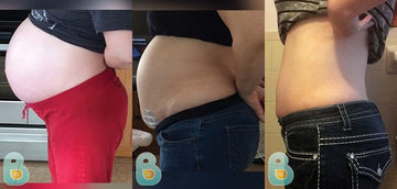 101-Kristine-K-Bellefit-Results-Before-and-After-Bellefit-SLIDE