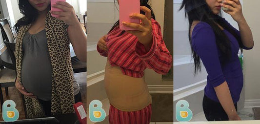 102-Larissa-V-Bellefit-Results-Before-and-After-Bellefit-SLIDE