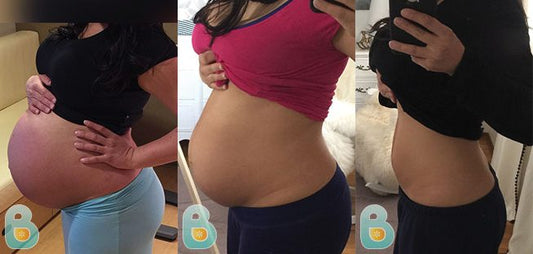 103-Larissa-G-Bellefit-Results-Before-and-After-Bellefit-SLIDE