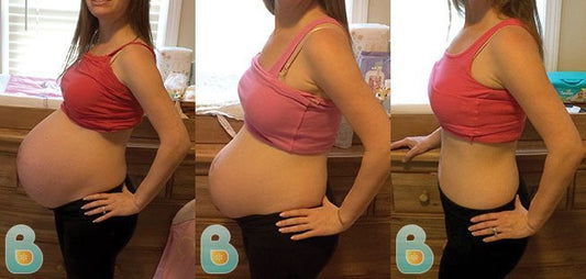 105-Laurie-N-Bellefit-Results-Before-and-After-Bellefit-SLIDE