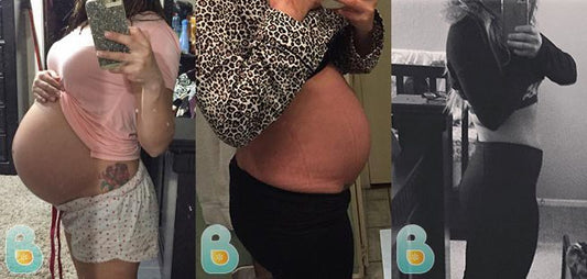 106-Leidi-J-Bellefit-Results-Before-and-After-Bellefit-SLIDE