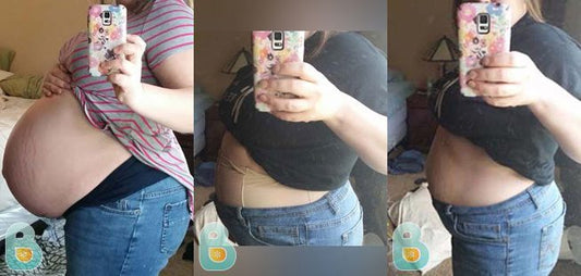 108-Linda-H-Bellefit-Results-Before-and-After-Bellefit-SLIDE