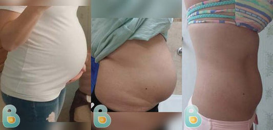 11-Amy-S-Bellefit-Results-Before-and-After-Bellefit-SLIDE