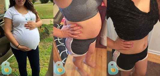 113-Liria-M-Bellefit-Results-Before-and-After-Bellefit-SLIDE