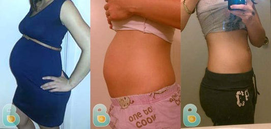 114-Loni-F-Bellefit-Results-Before-and-After-Bellefit-SLIDE