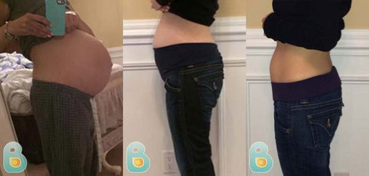 115-Lori-K-Bellefit-Results-Before-and-After-Bellefit-SLIDE