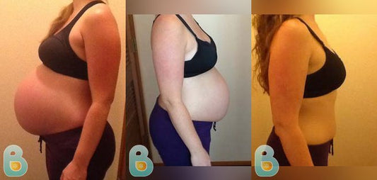 116-Louise-D-Bellefit-Results-Before-and-After-Bellefit-SLIDE