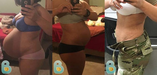 117-Lydia-E-Bellefit-Results-Before-and-After-Bellefit-SLIDE