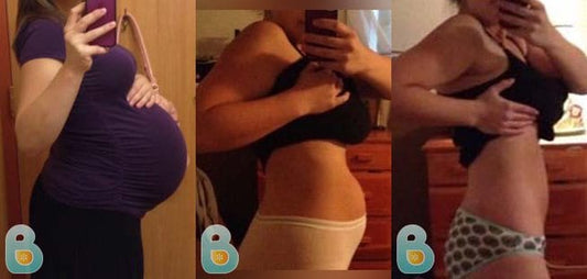 118-Madison-H-Bellefit-Results-Before-and-After-Bellefit-SLIDE