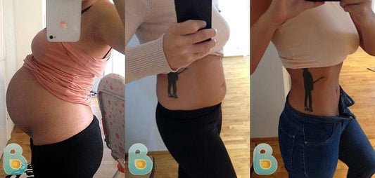 119-Malva-G-Bellefit-Results-Before-and-After-Bellefit-SLIDE