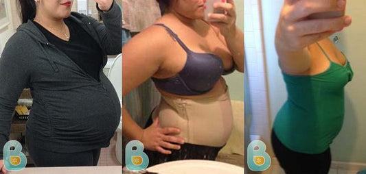 121-Maria-S-Bellefit-Results-Before-and-After-Bellefit-SLIDE