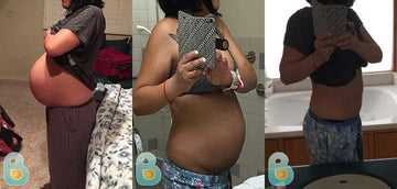 122-Maria-K-Bellefit-Results-Before-and-After-Bellefit-SLIDE