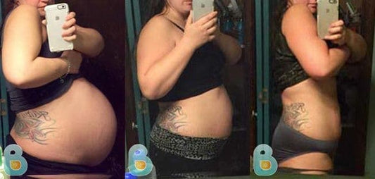 125-Megan-P-Bellefit-Results-Before-and-After-Bellefit-SLIDE