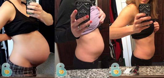 126-Megan-S-Bellefit-Results-Before-and-After-Bellefit-SLIDE