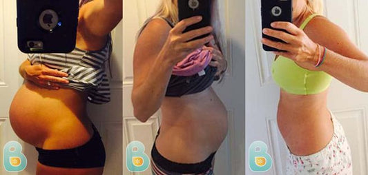 127-Meghan-D-Bellefit-Results-Before-and-After-Bellefit-SLIDE
