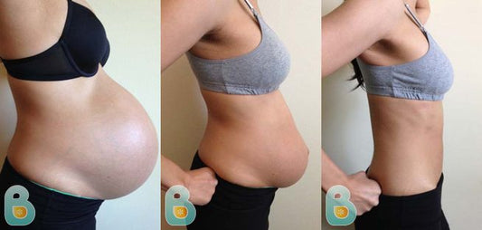 129-Melissa-O-Bellefit-Results-Before-and-After-Bellefit-SLIDE