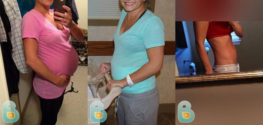132-Michelle-D-Bellefit-Results-Before-and-After-Bellefit-SLIDE