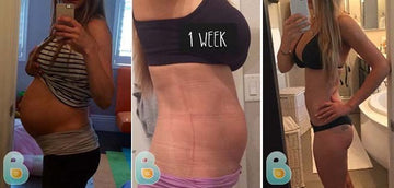134-Monika-N-Bellefit-Results-Before-and-After-Bellefit-SLIDE