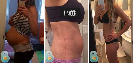 134-Monika-N-Bellefit-Results-Before-and-After-Bellefit-SLIDE
