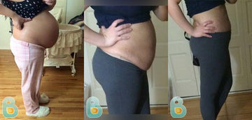 136-Nathalia-D-Bellefit-Results-Before-and-After-Bellefit-SLIDE