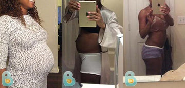137-Olufela-A-Bellefit-Results-Before-and-After-Bellefit-SLIDE