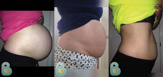 14-Angela-K-Bellefit-Results-Before-and-After-Bellefit-SLIDE