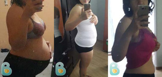 141-Rita-A-Bellefit-Results-Before-and-After-Bellefit-SLIDE
