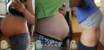 143-Rosa-V-Bellefit-Results-Before-and-After-Bellefit-SLIDE