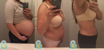 144-Rosy-R-Bellefit-Results-Before-and-After-Bellefit-SLIDE