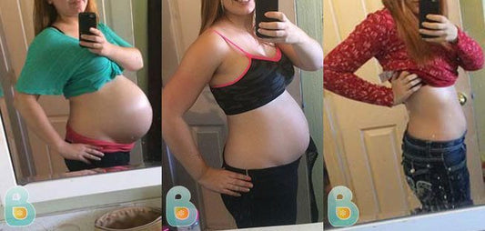 146-Sami-A-Bellefit-Results-Before-and-After-Bellefit-SLIDE