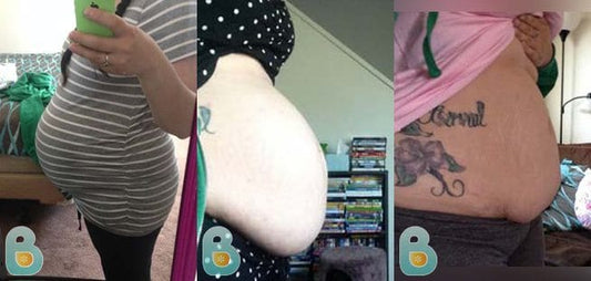 147-Sara-B-Bellefit-Results-Before-and-After-Bellefit-SLIDE