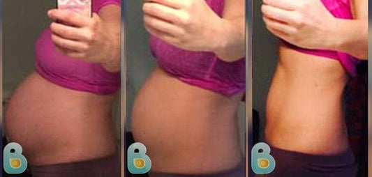 150-Stacy-S-Bellefit-Results-Before-and-After-Bellefit-SLIDE