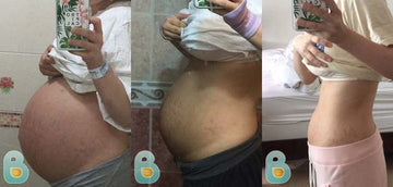 154-Sue-M-Bellefit-Results-Before-and-After-Bellefit-SLIDE