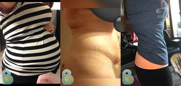 155-Tara-B-Bellefit-Results-Before-and-After-Bellefit-SLIDE