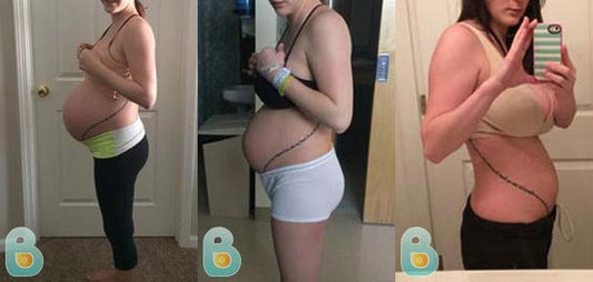 158-Torey-F-Bellefit-Results-Before-and-After-Bellefit-SLIDE