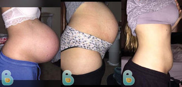 16-Angelica-B-Bellefit-Results-Before-and-After-Bellefit-SLIDE