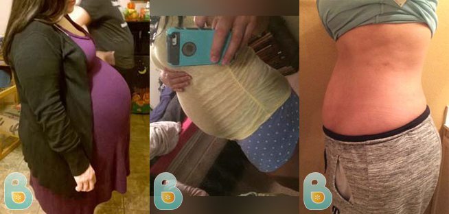 Bellefit Corset Review, Bellefit Before And After