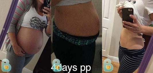 162-Yuliet-A-Bellefit-Results-Before-and-After-Bellefit-SLIDE