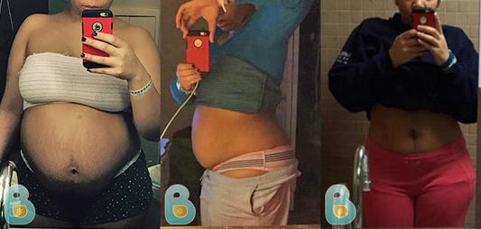 164-Corella-B-Bellefit-Results-Before-and-After-Bellefit-SLIDE