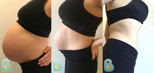 166-Valeria-M-Bellefit-Results-Before-and-After-Bellefit-SLIDE-1