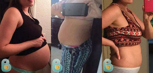 17-Anna-S-Bellefit-Results-Before-and-After-Bellefit-SLIDE