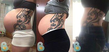 171-Ashley-H-Bellefit-Results-Before-and-After-Bellefit-SLIDE