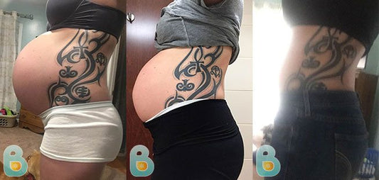 171-Ashley-H-Bellefit-Results-Before-and-After-Bellefit-SLIDE