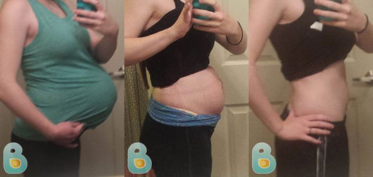 172-Brianna-K-Bellefit-Results-Before-and-After-Bellefit-SLIDE