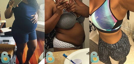 173-Tyree-S-Bellefit-Results-Before-and-After-Bellefit-SLIDE