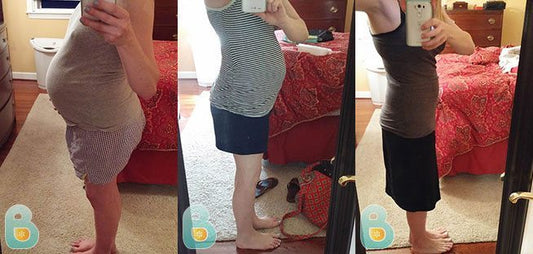 175-Amanda-P-Bellefit-Results-Before-and-After-Bellefit-SLIDE