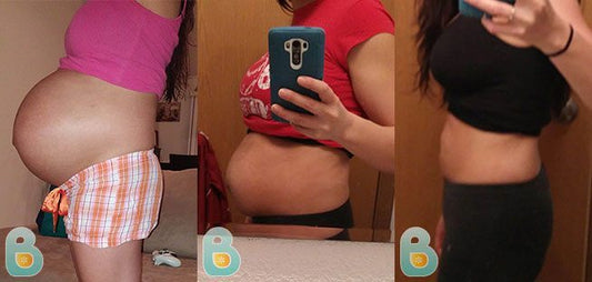 176-Adela-V-Bellefit-Results-Before-and-After-Bellefit-SLIDE